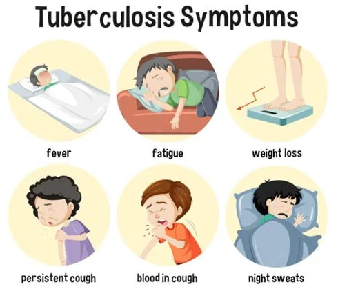 Global TB Report 2024 : India Performs explained for UPSC