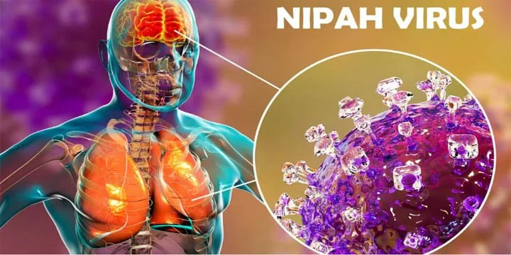 Nipah Virus